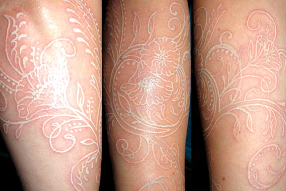Tatuagem Tinta Branca: Entenda o método e os riscos envolvidos