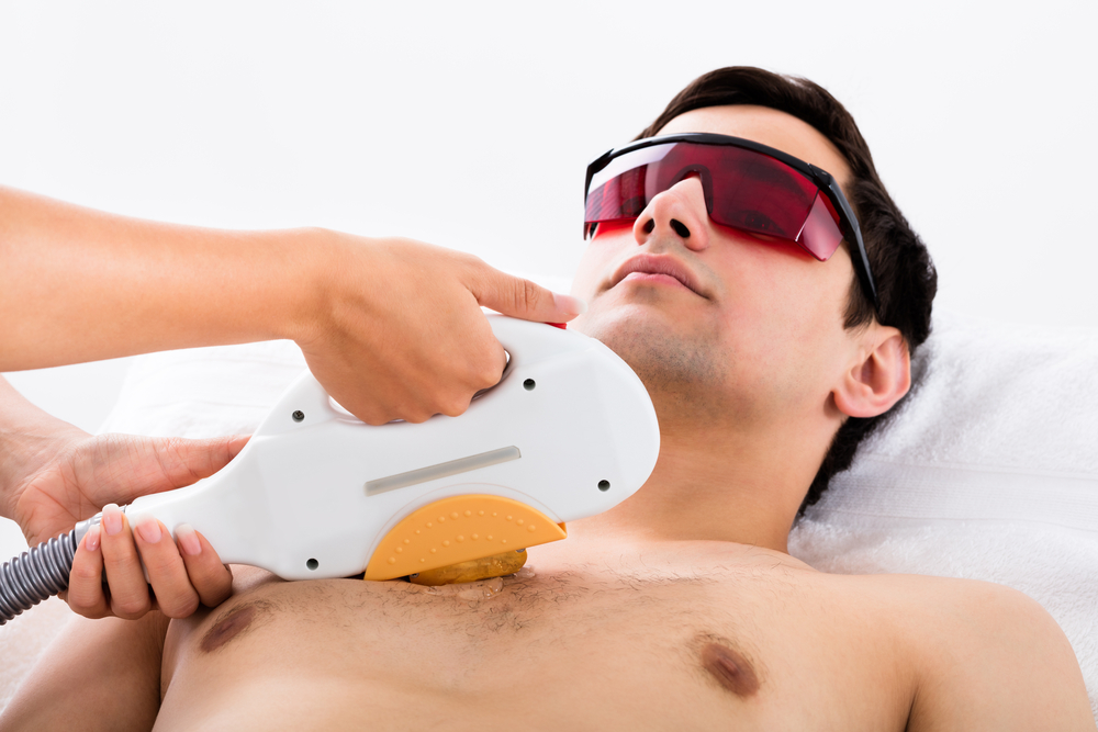 Tudo o que você precisa saber sobre a depilação a laser